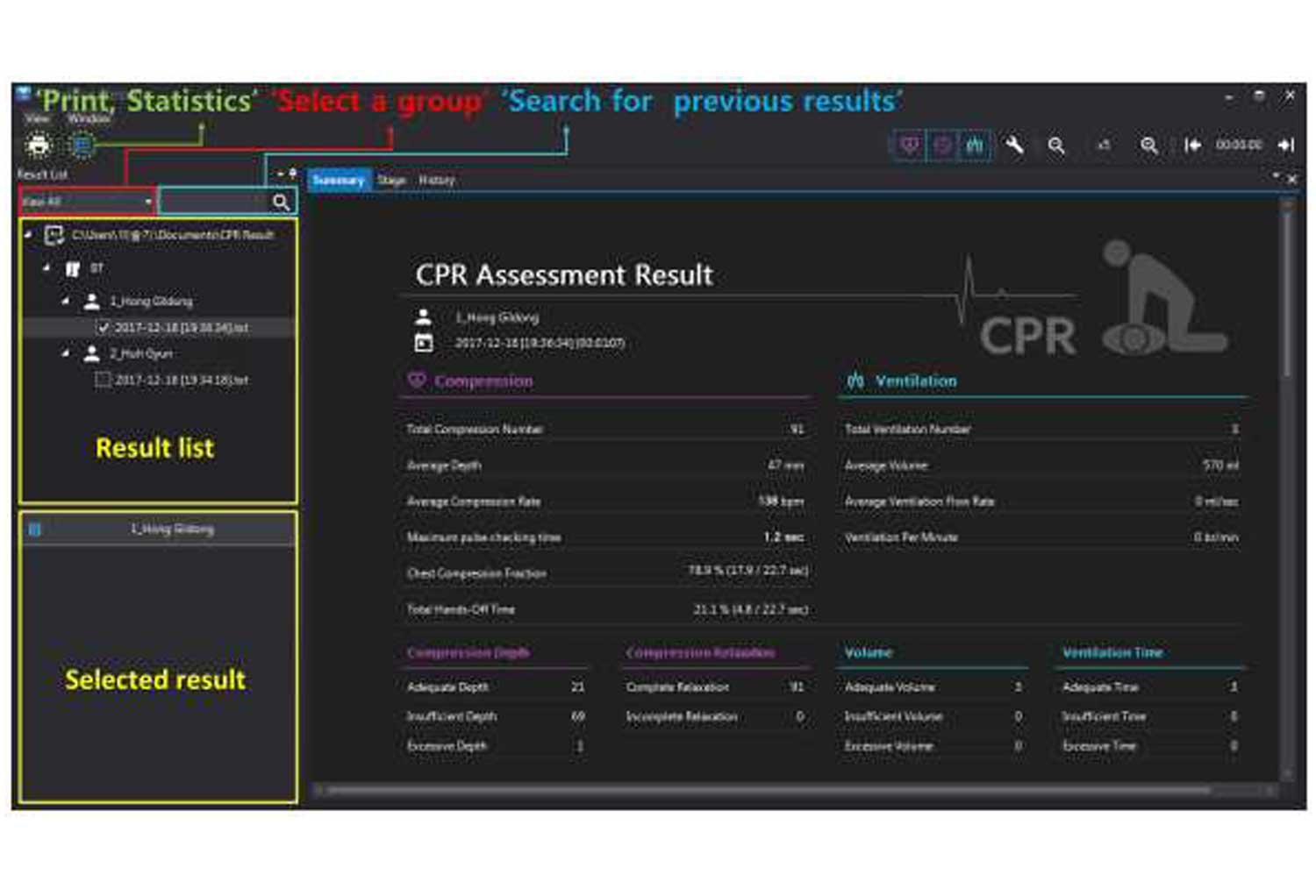 Adult ,Advance CPR simulator